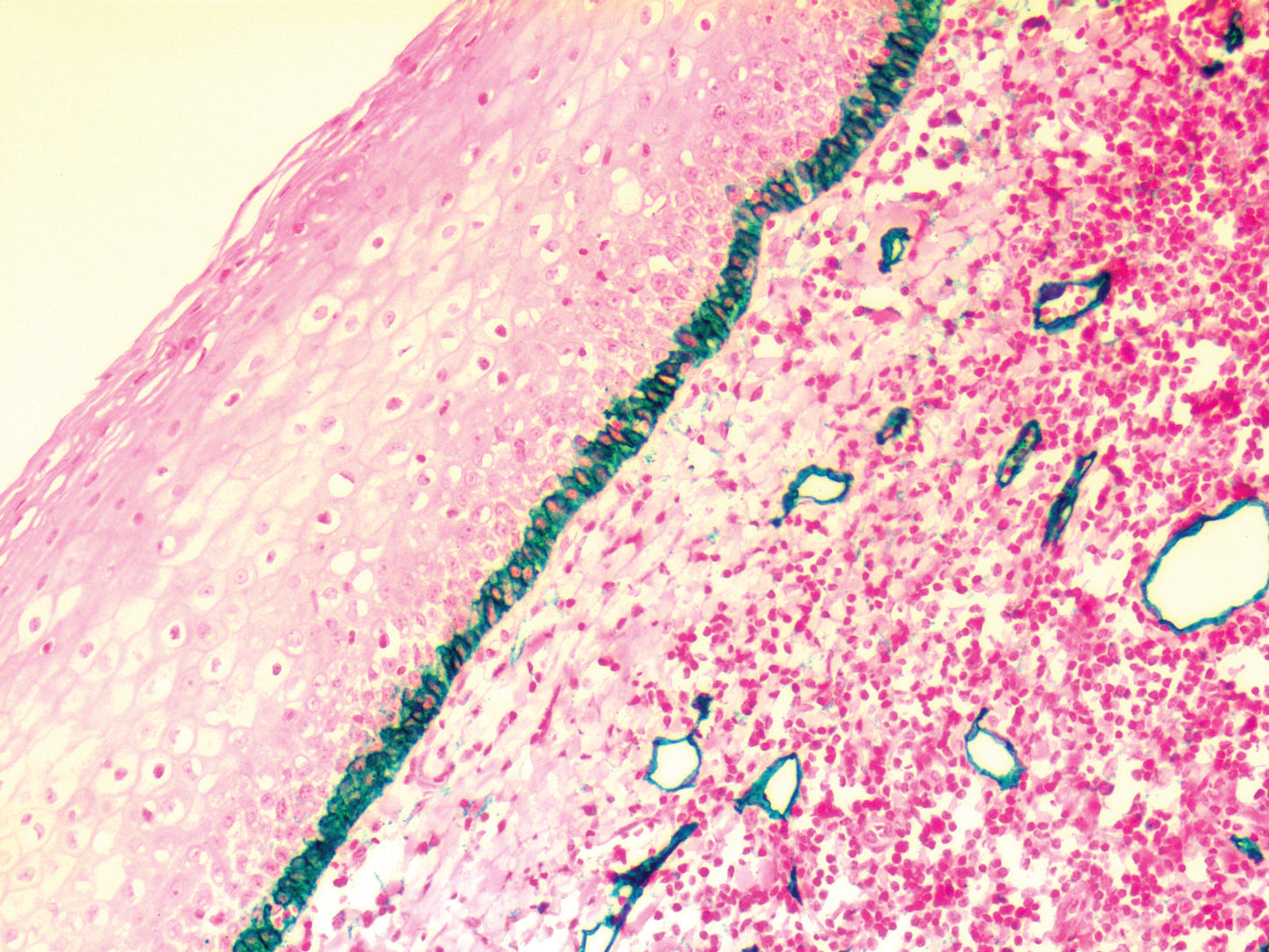 Podoplanin\D2-40
