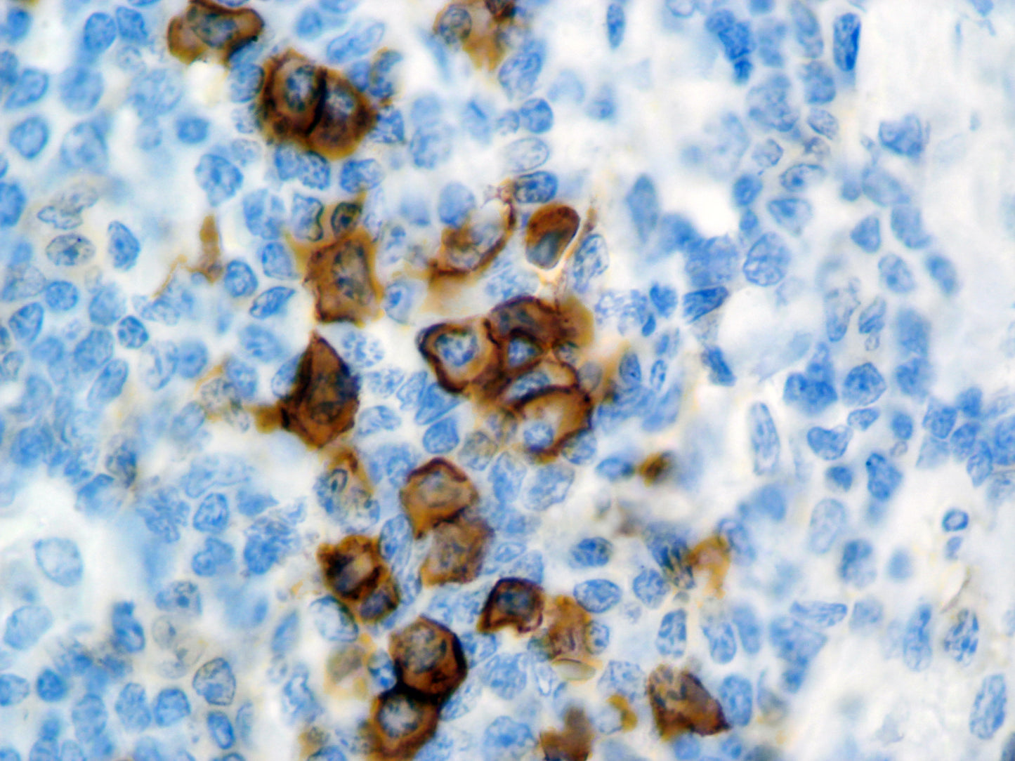 CD38