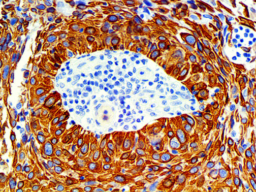 Cytokeratin 14