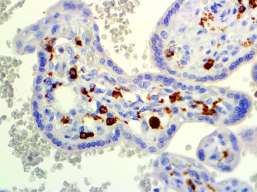 CD14