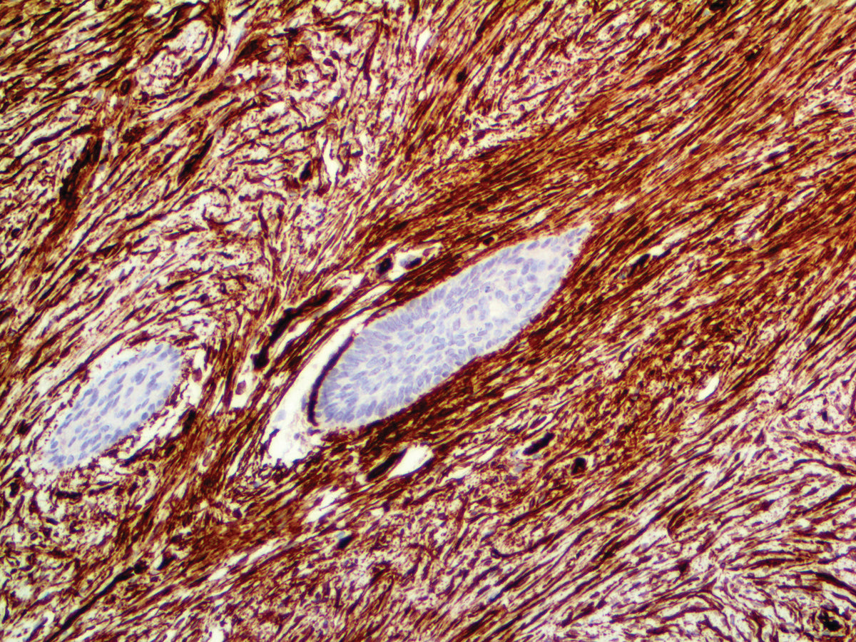 CD34