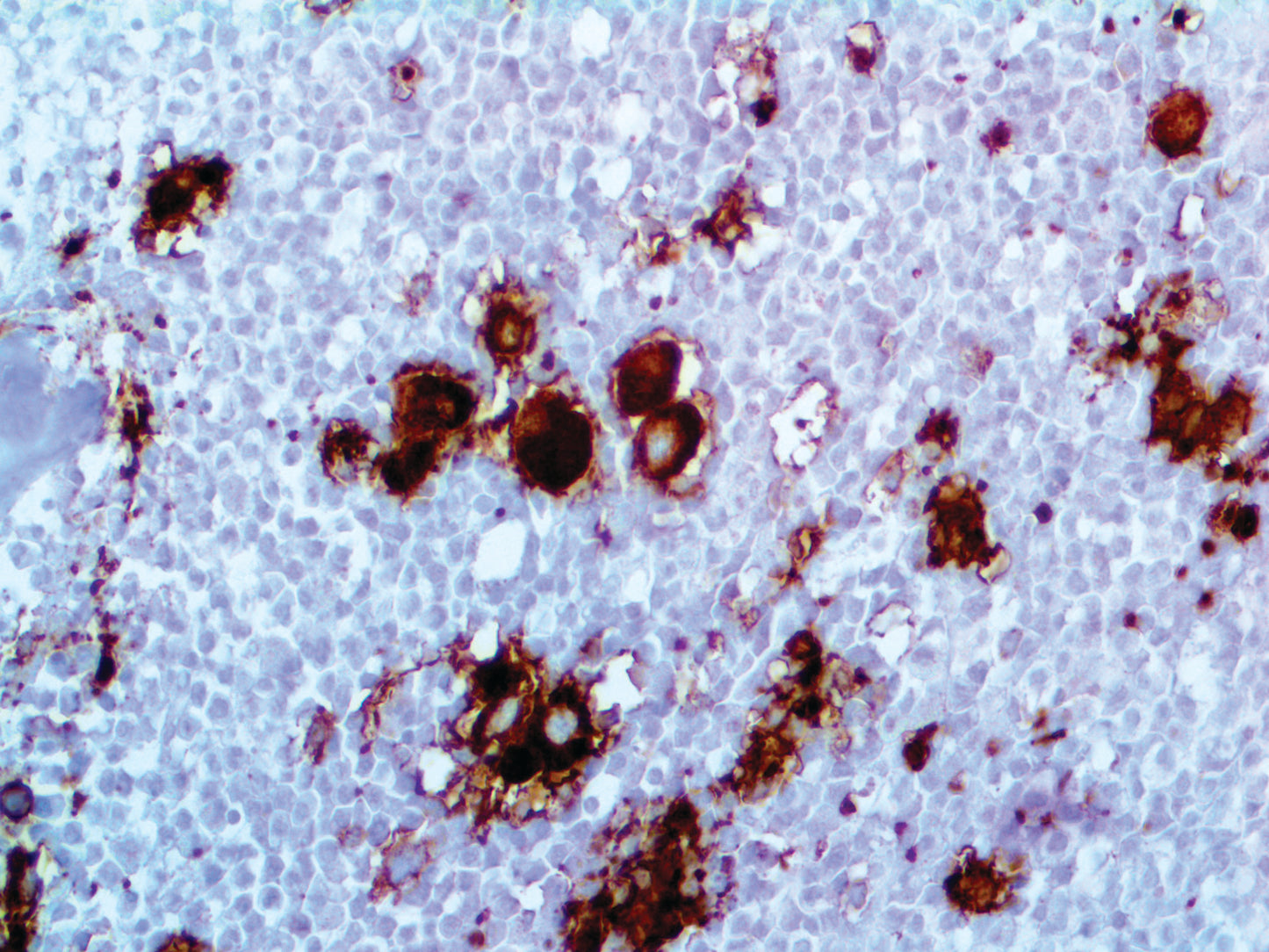 CD41\Integrin alpha IIb