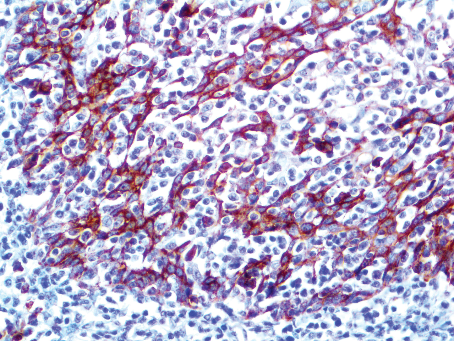 CD138