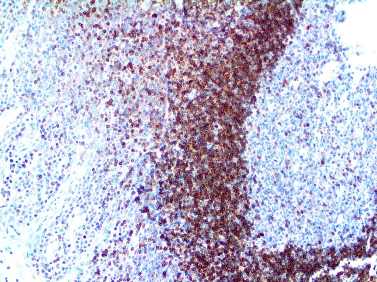 bcl-2
