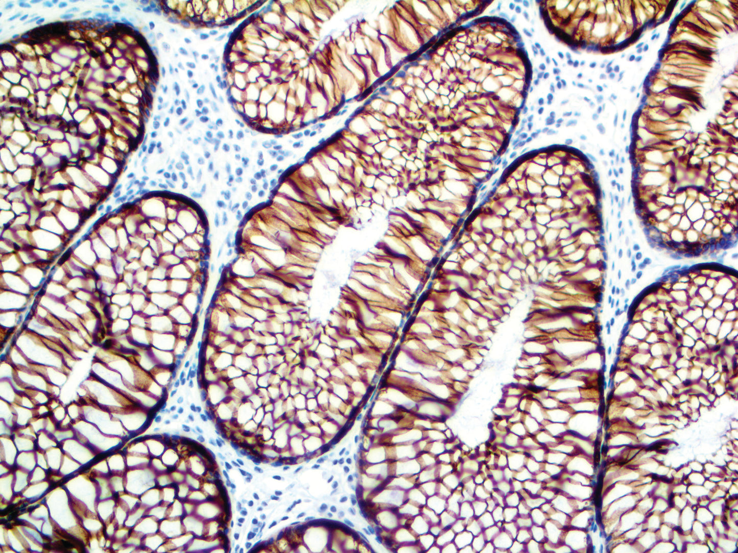 Cytokeratin 18