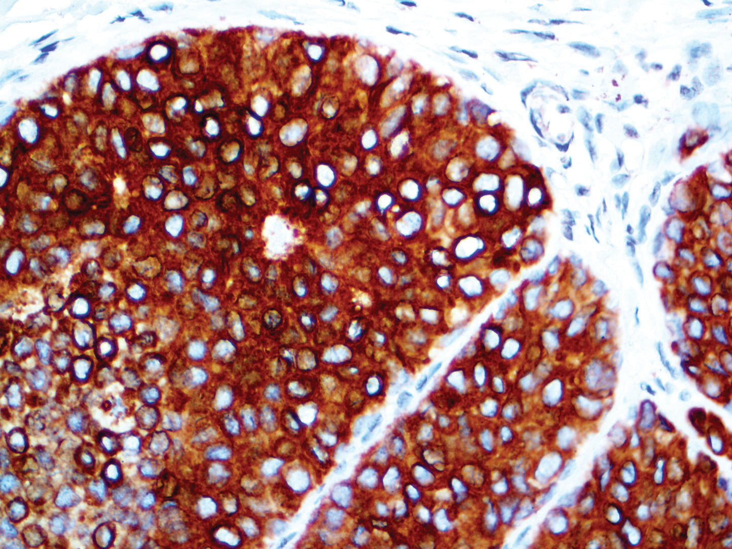 EpCAM\Epithelial Specific Antigen