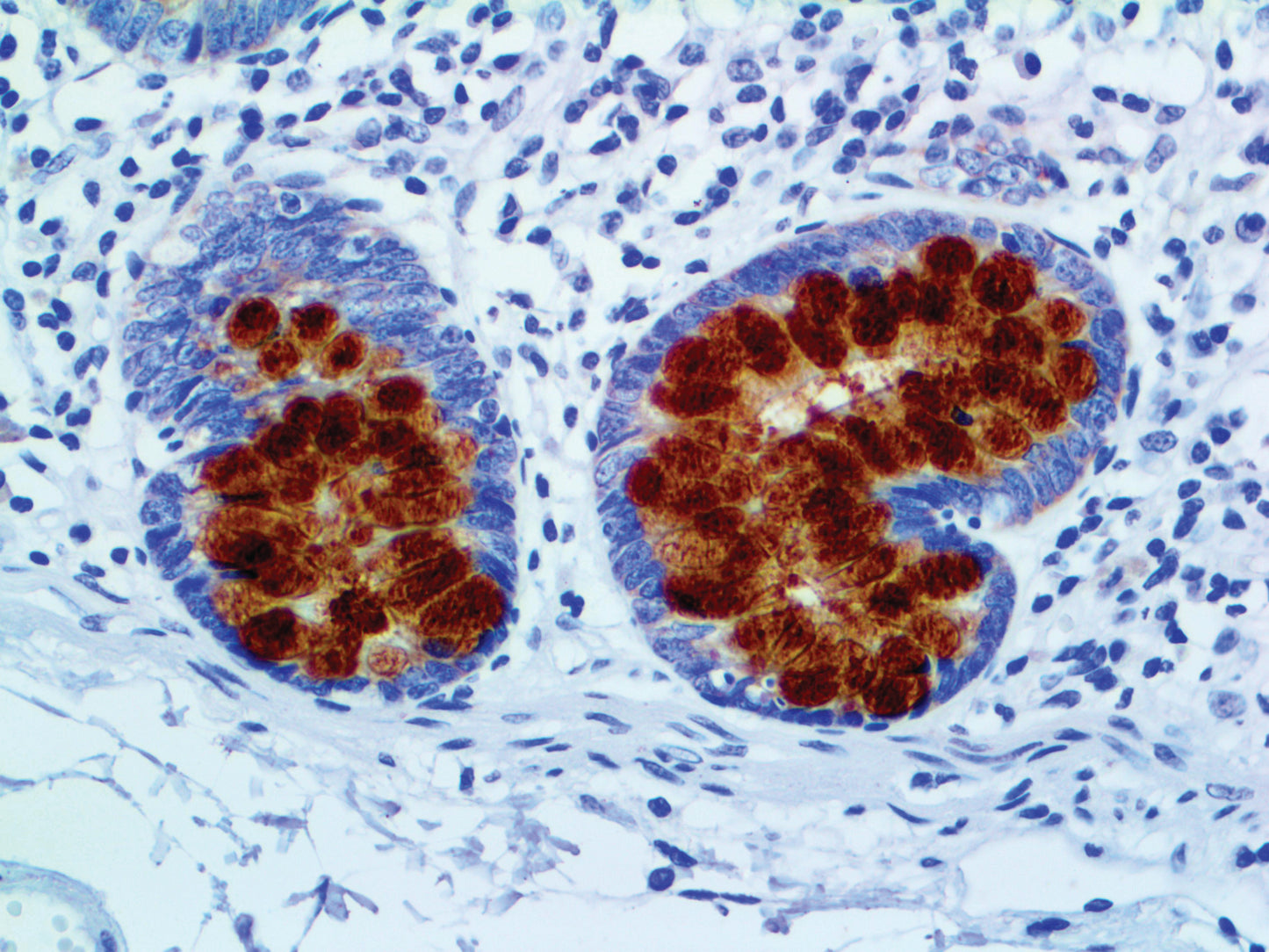 MUC2