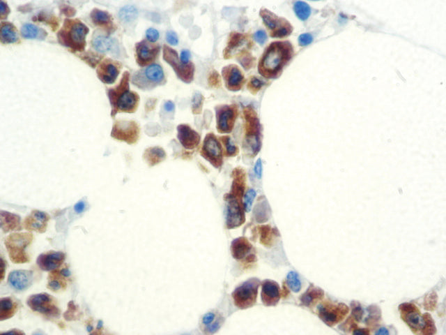 Myeloperoxidase