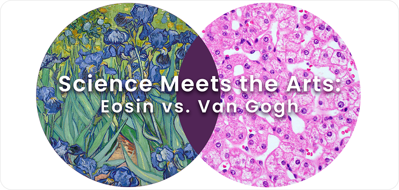 Science Meets the Arts Part 2: Eosin vs Van Gogh