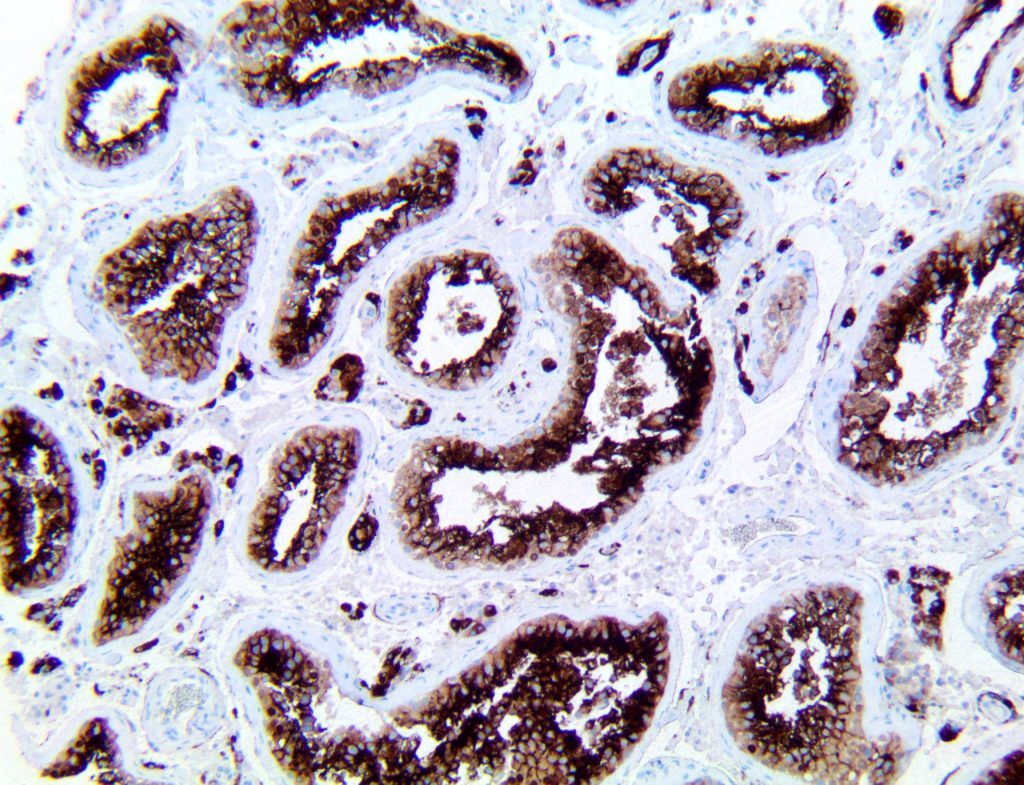 Antibodies