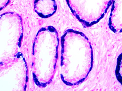 Detection Systems