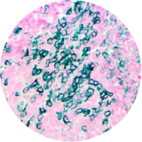 Fast Mohs IHC