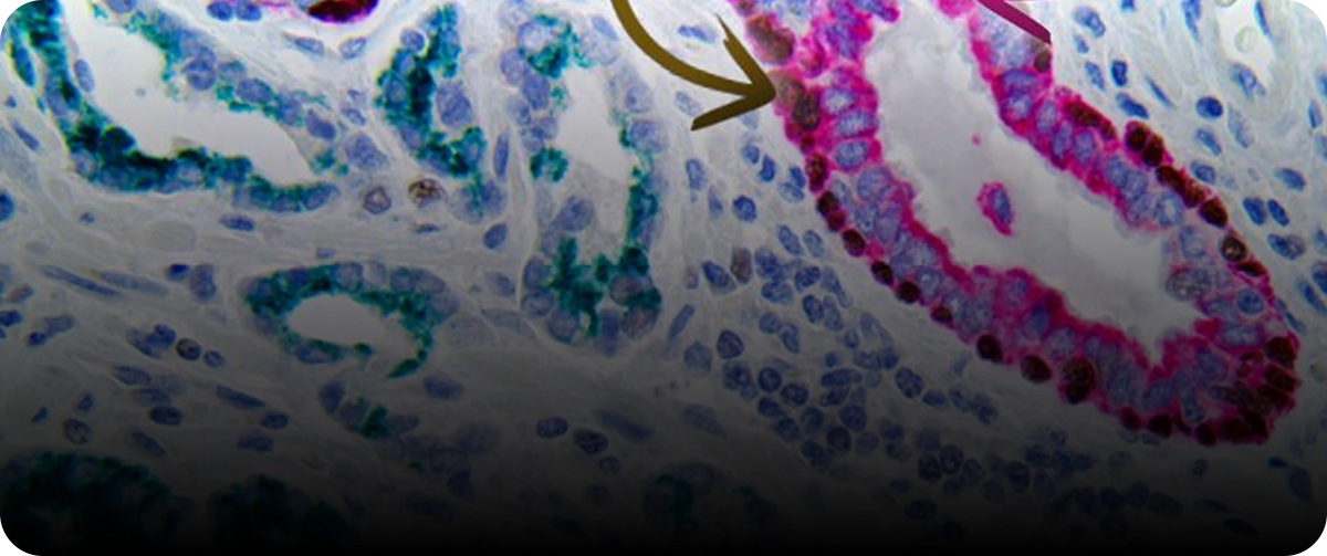 Multiplex Immunohistochemistry