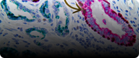 Multiplex Immunohistochemistry
