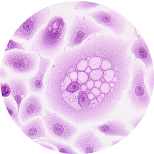 Immunofluores-cence (IF)
