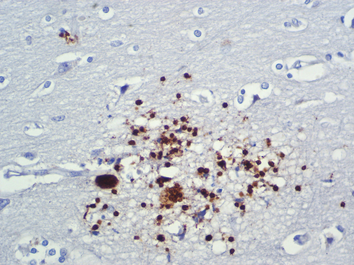 Toxoplasma gondii