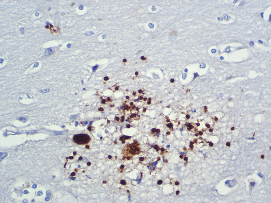 Toxoplasma gondii