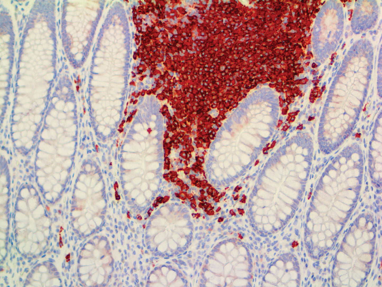 CD19