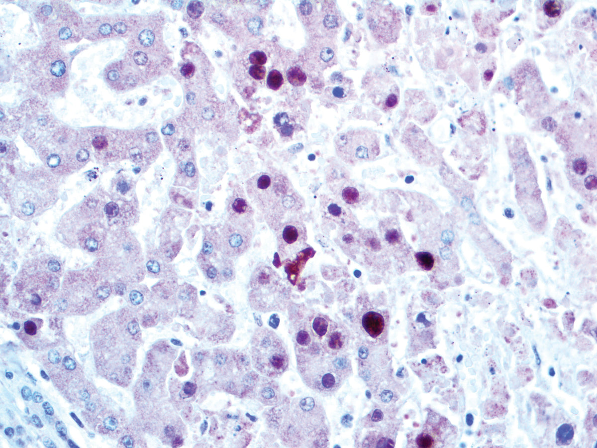 Adenovirus
