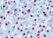 Hepatitis B Virus Core Antigen
