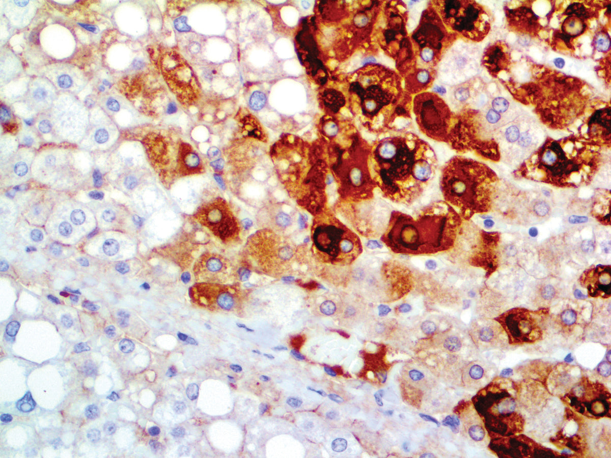 Hepatitis B Virus Surface Antigen