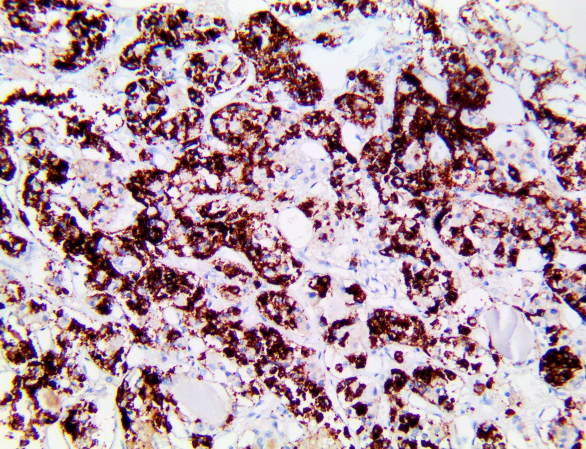 Prolactin