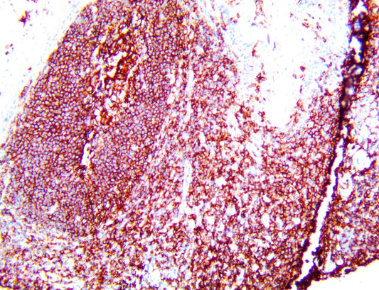 CD19