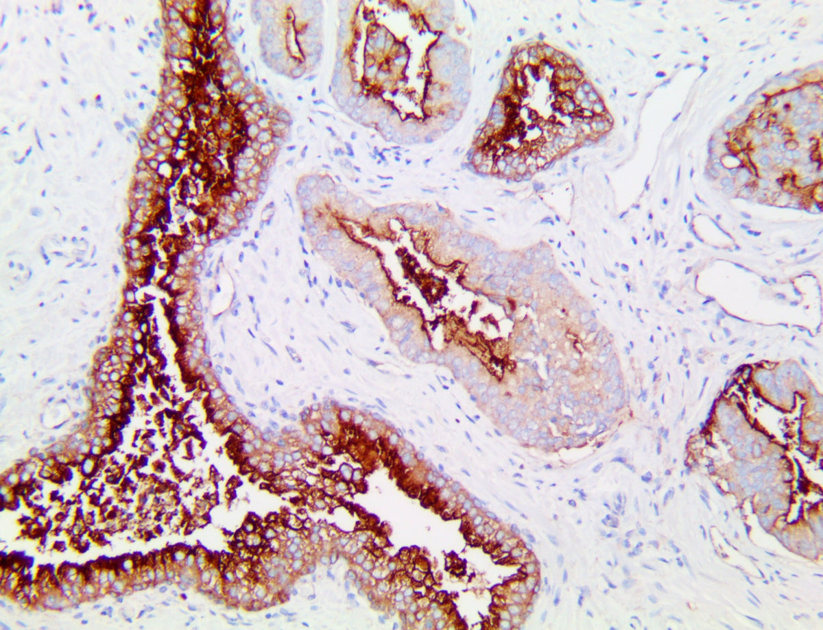 CD10