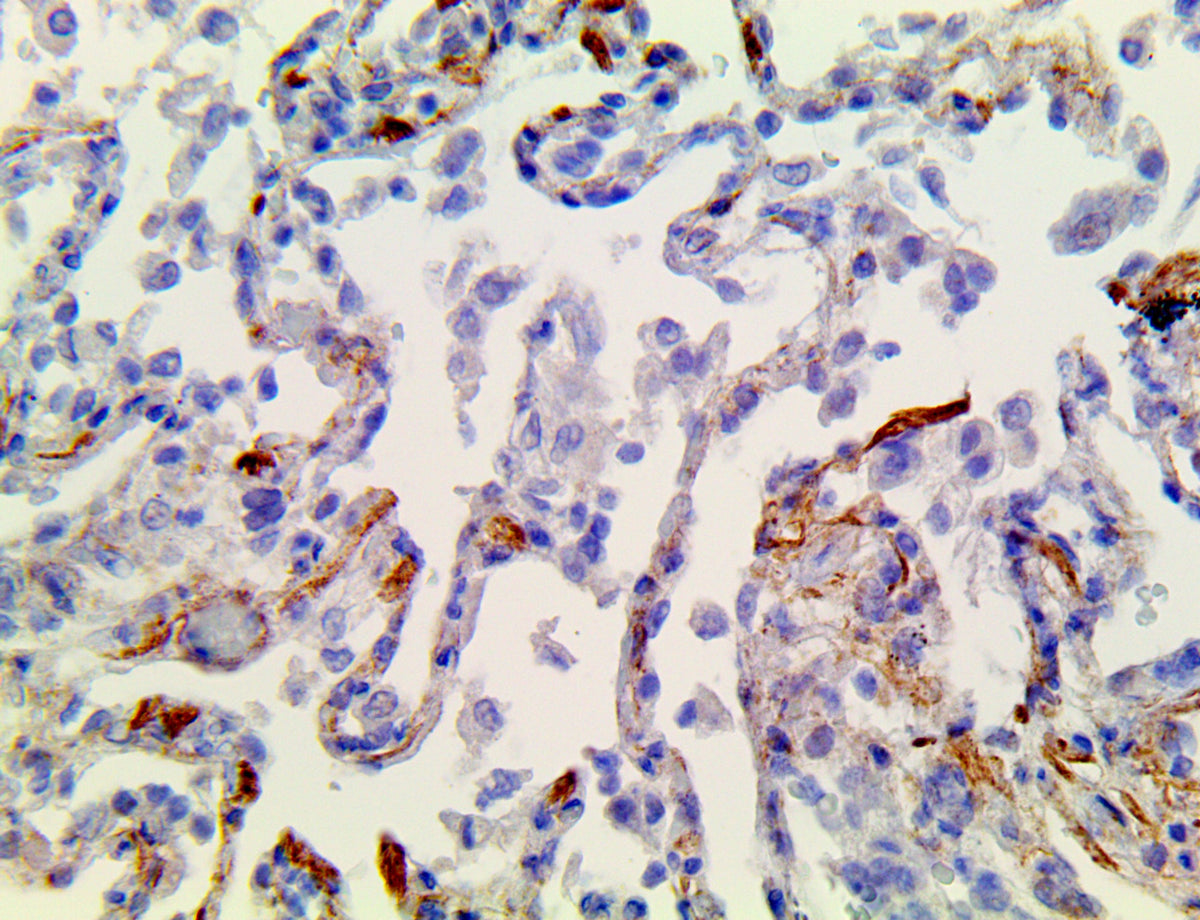 SARS-CoV-2