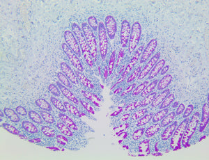 PolyDetector HRP Fuchsia