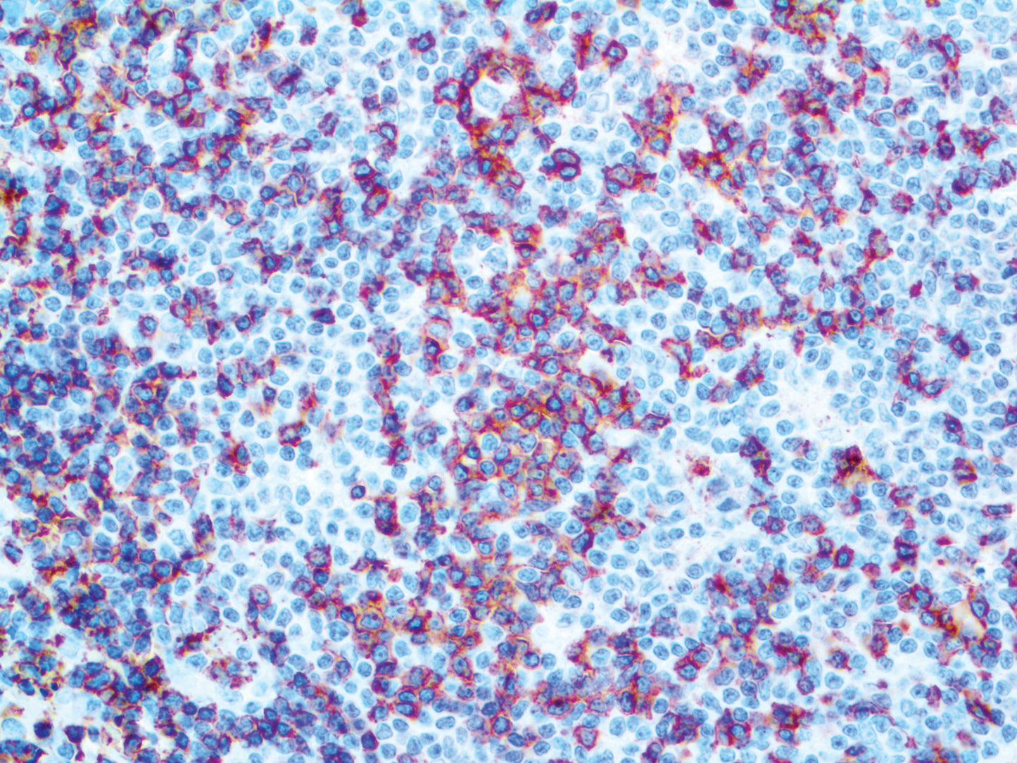 CD2