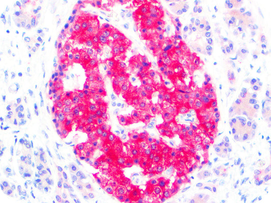 PolyDetector Alk Magenta