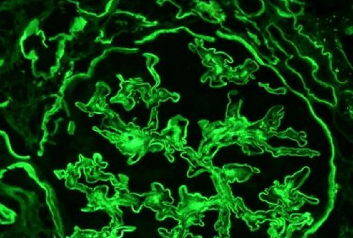 IF of Albumin on Frozen Kidney Tissue
