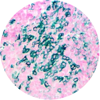 Fast Mohs IHC