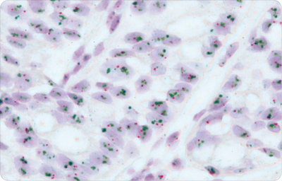 High Sensitivity and Specificity