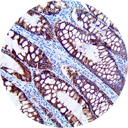 IHC Detection Systems