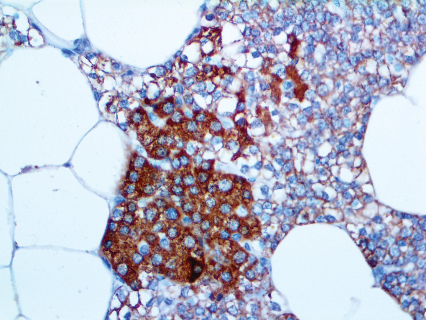 Parathyroid Hormone\PTH
