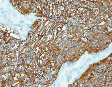 Synaptophysin