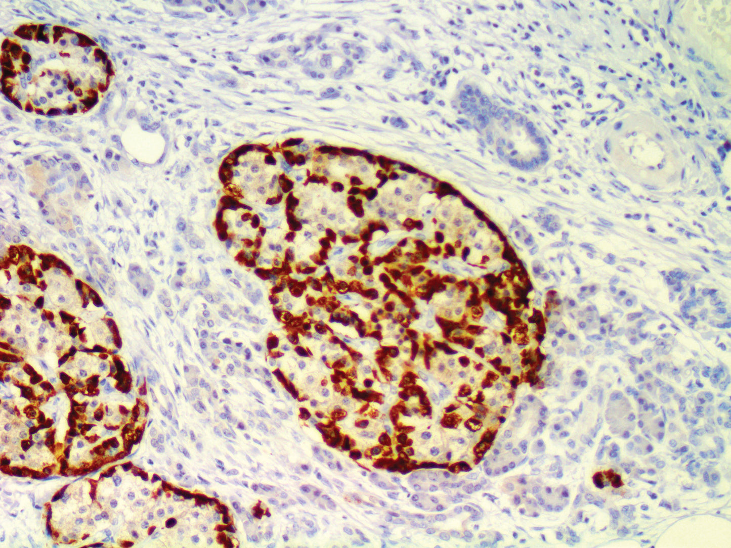 Glucagon