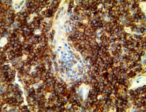PD-L1/CD274