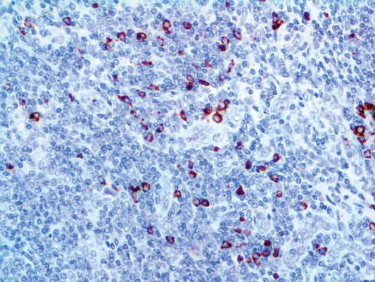 Granzyme B