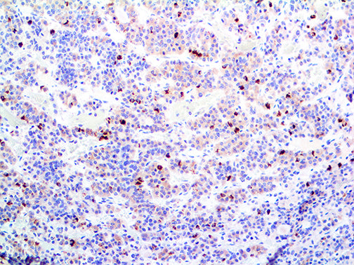 CD25
