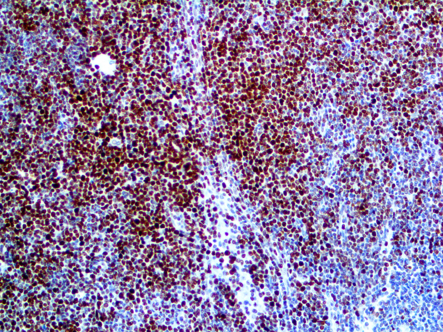 Histone H3 Phospho