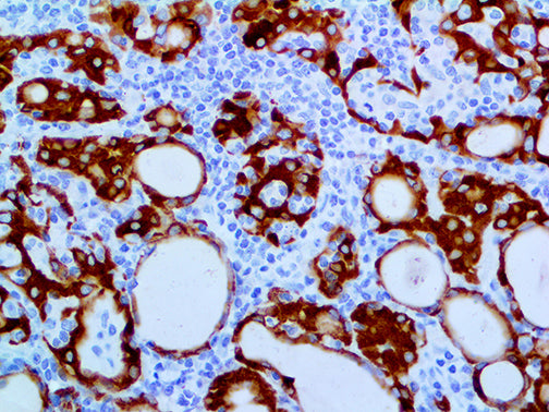 Thyroid Peroxidase