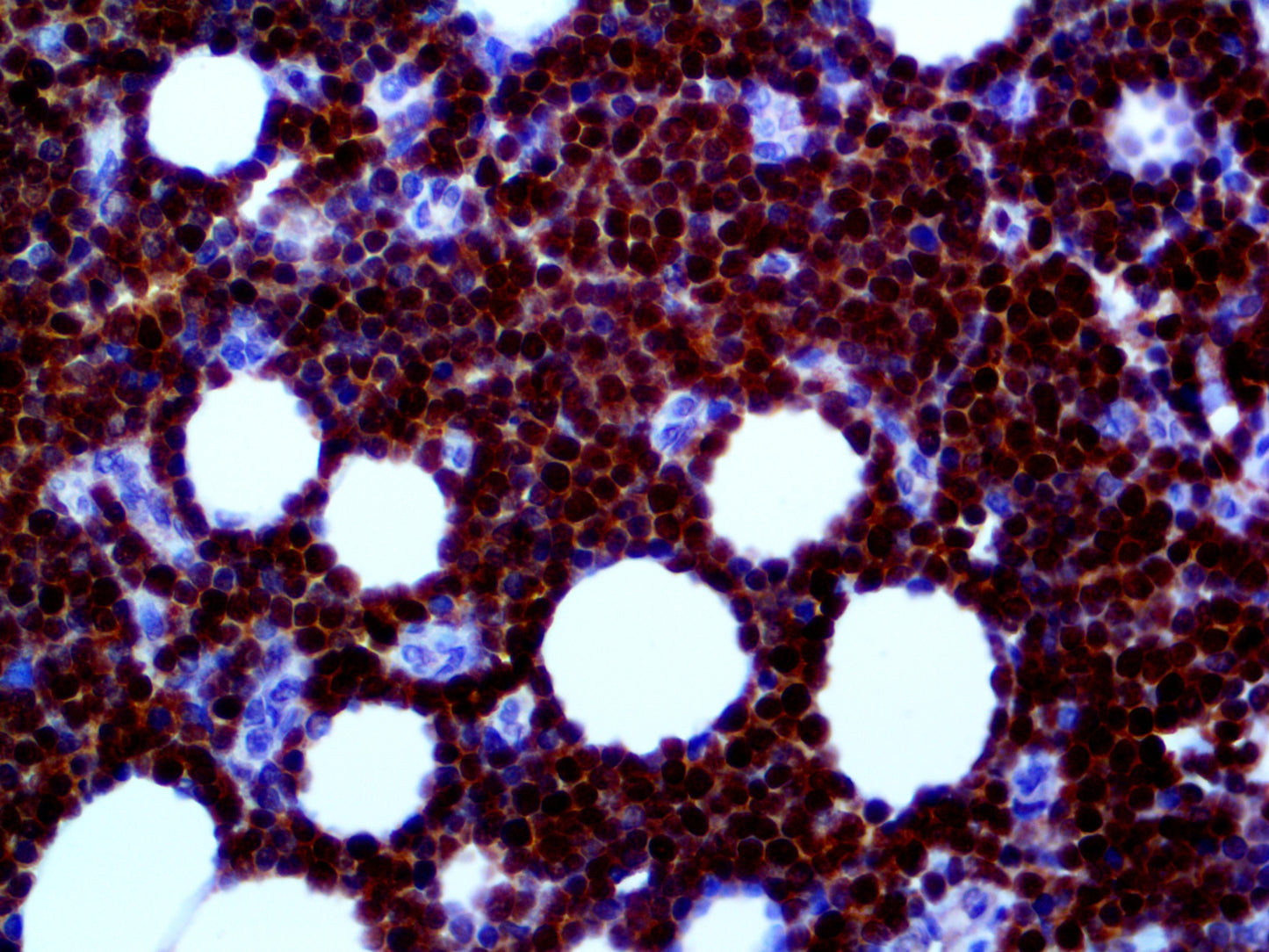 CDK2