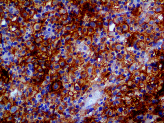 PD-L1/CD274