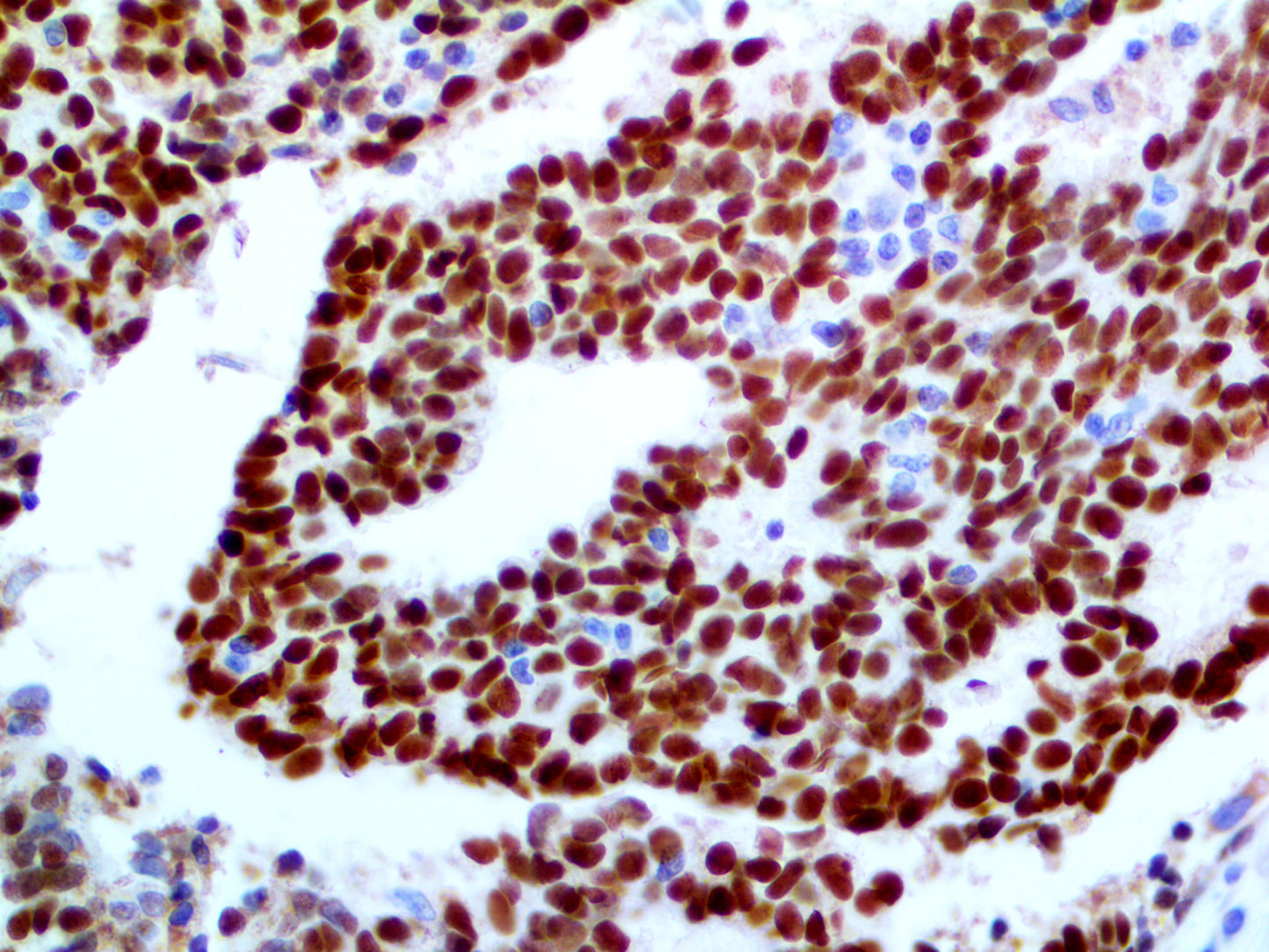 GATA3