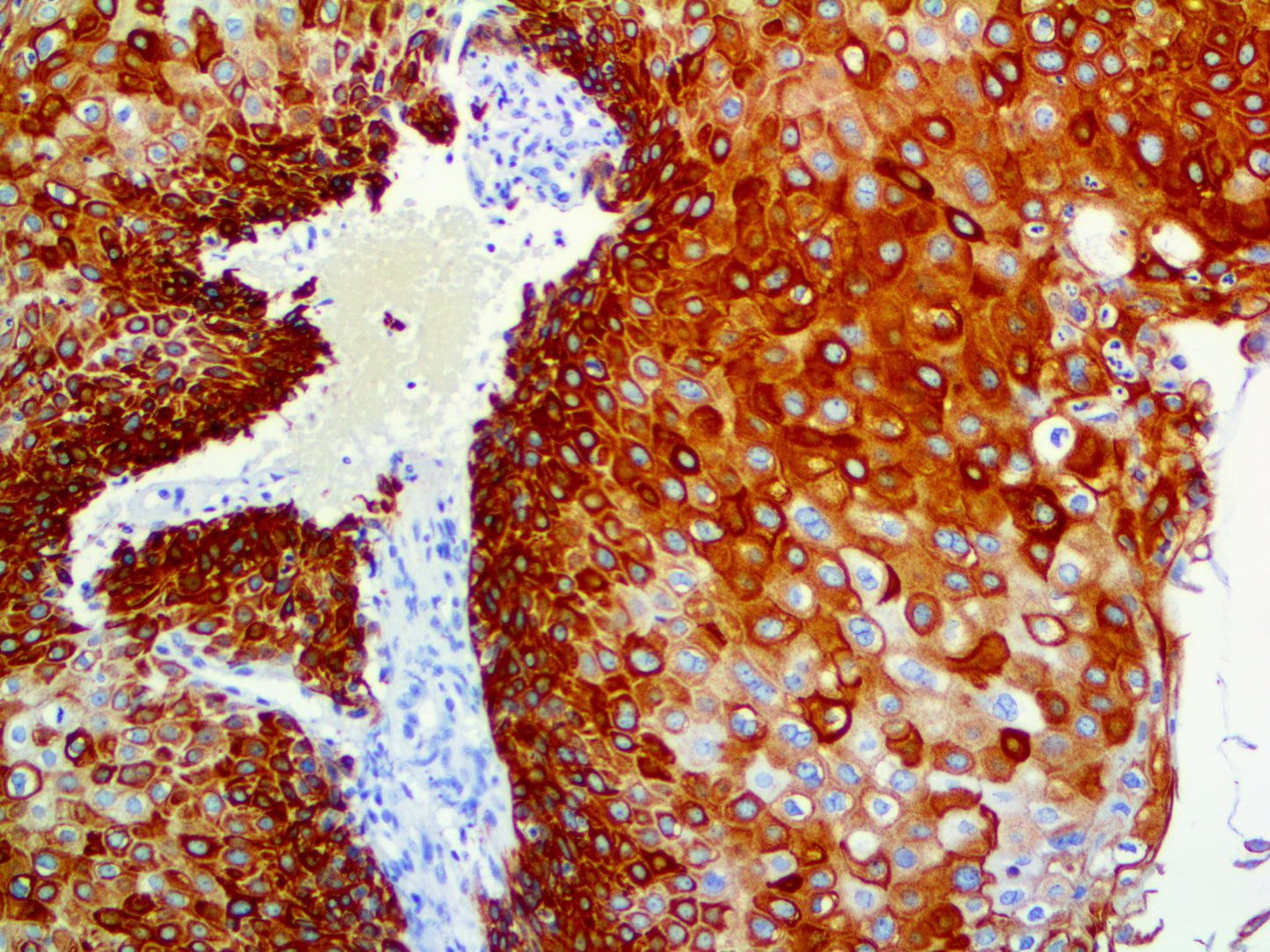 Cytokeratin 17