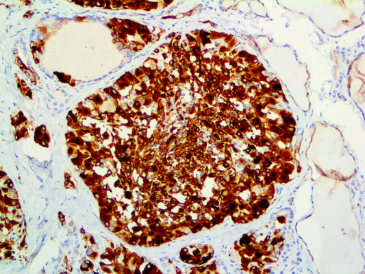 Cytokeratin 19