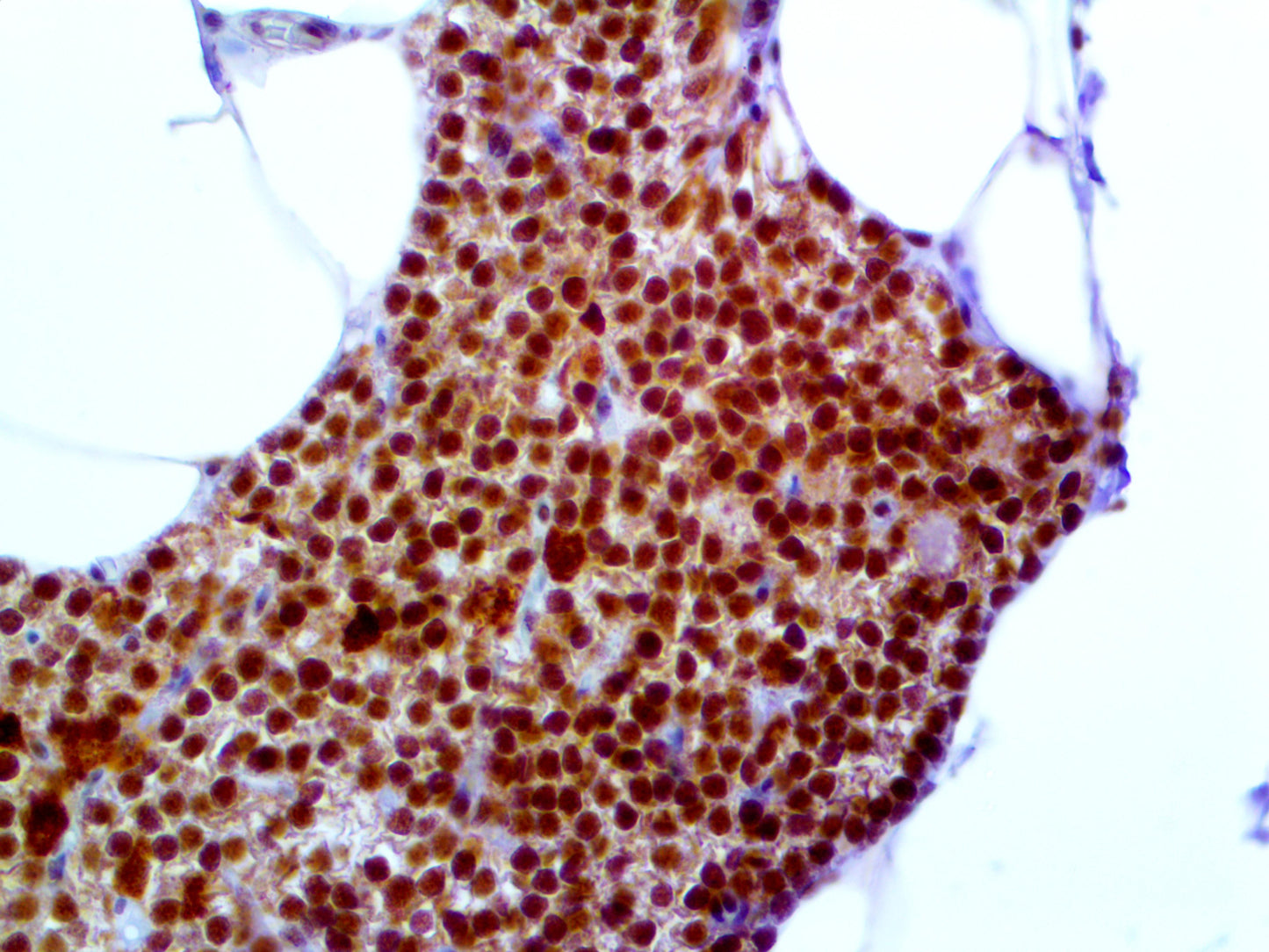 Parafibromin